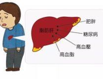 预防肝癌,有效预防肝癌的关键措施